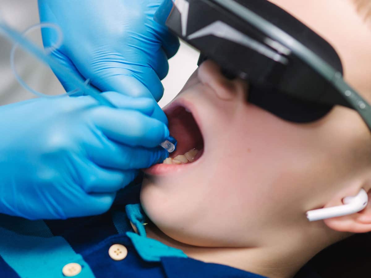tratamiento de caries dentista pediatrico en vigo